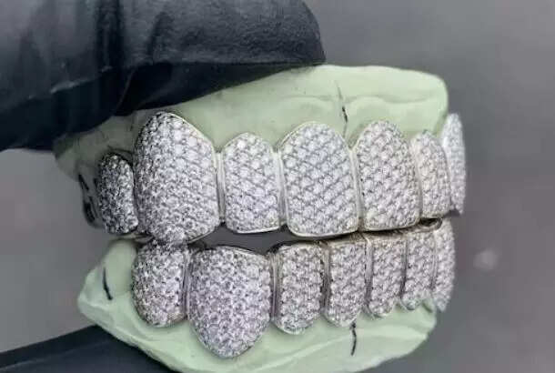 வைரத்தில் பற்கள் செய்த வியாபாரிகள்!! விலை எவ்வளவு தெரியுமா?