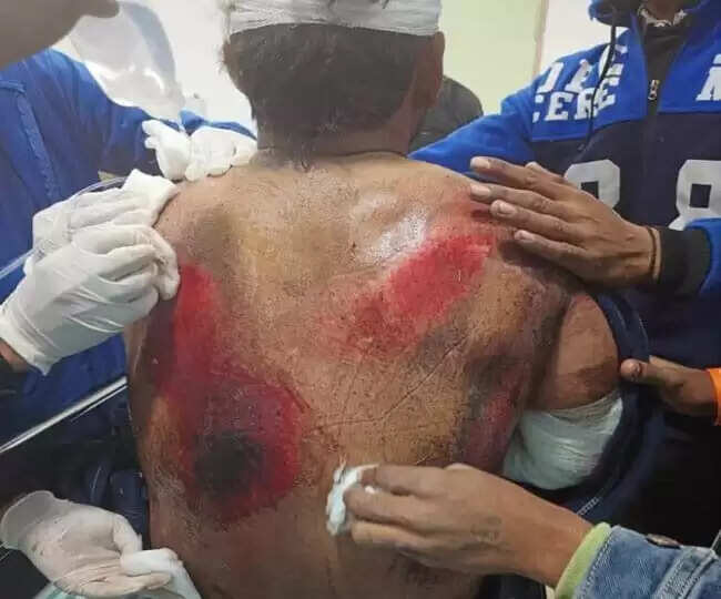 விபத்தில் சிக்கிய பிரபல கிரிக்கெட் வீரர்!!