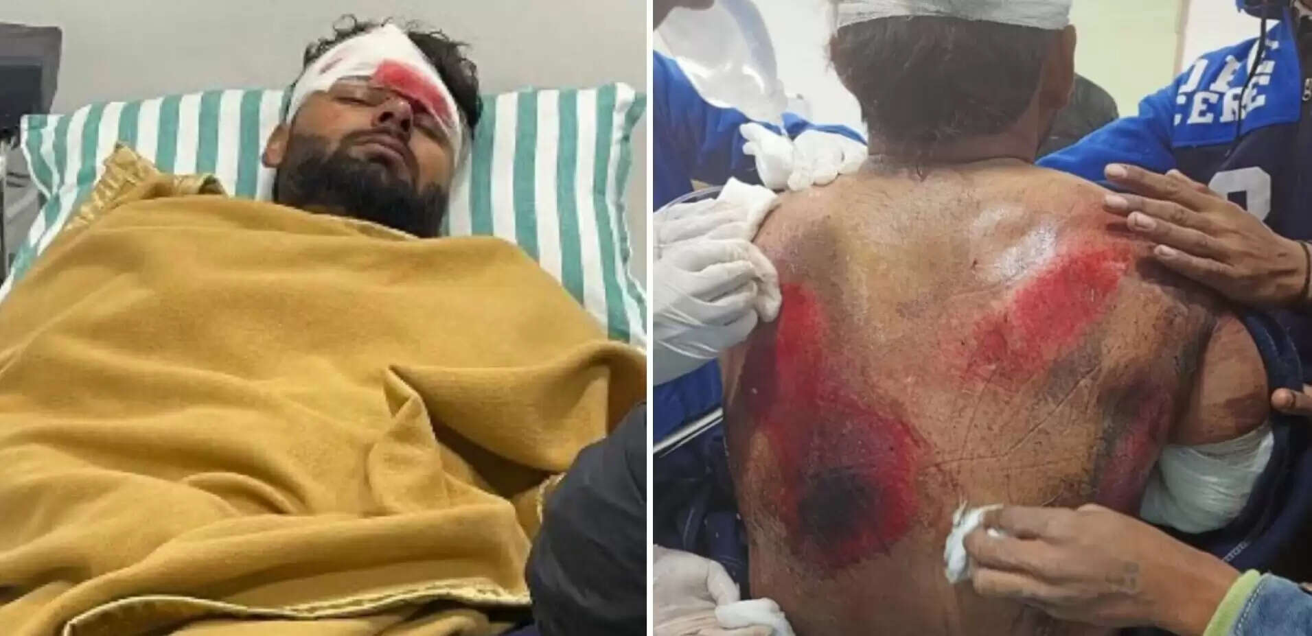 பண்ட் விபத்துக்கான காரணம் இதுதான் – பதற வைக்கும் வீடியோ!!