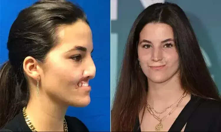 தான் வளர்த்த நாயால் உதடுகளை இழந்த மாடல் அழகி...! அறுவை சிகிச்சைக்கு பின் எப்படி இருக்கார் பாருங்க