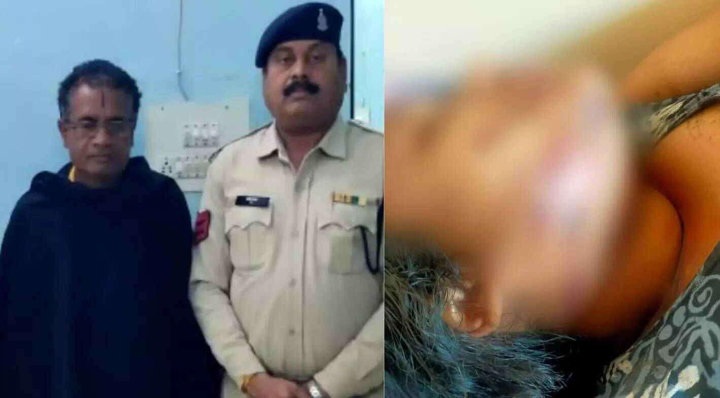 சிறுமியை தாக்கி வாயில் எரியும் கட்டையை வைத்த கொடூரம்!!