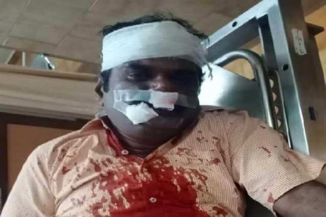 பத்திரிகையாளர் மீது கொலை வெறி தாக்குதல்!! அமைச்சர் ராஜேந்திர பாலாஜி மீது குற்றச்சாட்டு..