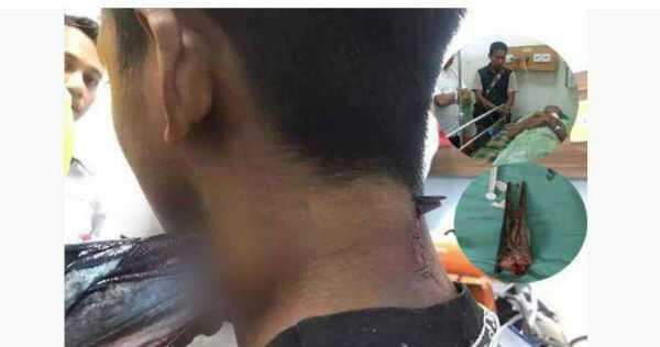 மீன் பிடிக்கப் போன சிறுவன்! கழுத்தை துளைத்து பாய்ந்த மீன்!