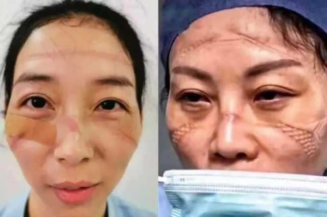 3 மணி நேரமே தூக்கம்! உணவு இல்லை! சீன நர்ஸ்களின் பரிதாப நிலை!