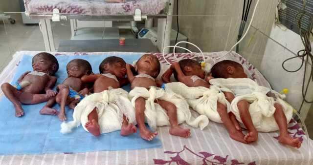 ஒரே பிரசவத்தில் 6 குழந்தைகளை பெற்ற தாய்!! அரசு மருத்துவமனையில் சாதனை..