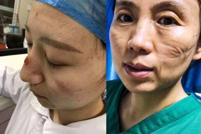 3 மணி நேரமே தூக்கம்! உணவு இல்லை! சீன நர்ஸ்களின் பரிதாப நிலை!