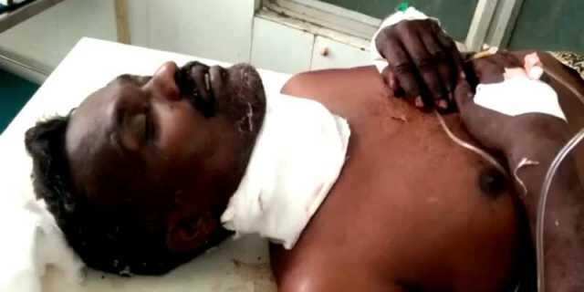 மனைவியை கொன்ற சந்தேகம்.. கணவரும் தற்கொலைக்கு முயன்றதால் பரபரப்பு!!