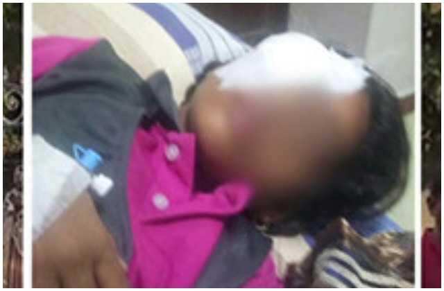 பிரம்பு முறியும் அளவிற்கு அடித்த ஆசிரியர்.. கருவிழி கிழிந்து மாணவிக்கு கண் பார்வை பறிபோன அதிர்ச்சி..