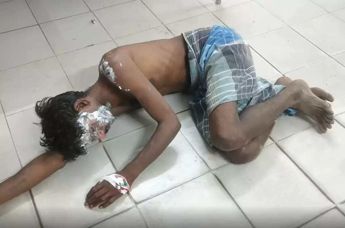 போதையில் பாலியல் தொல்லை.. சூடான ரசத்தை ஊற்றிய மனைவி..!