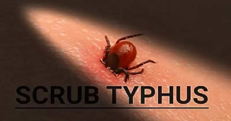 வடமாநிலங்களை மிரட்டும் புது வைரஸ்.. ஸ்க்ரப் டைபஸ் அறிகுறிகள் என்ன?