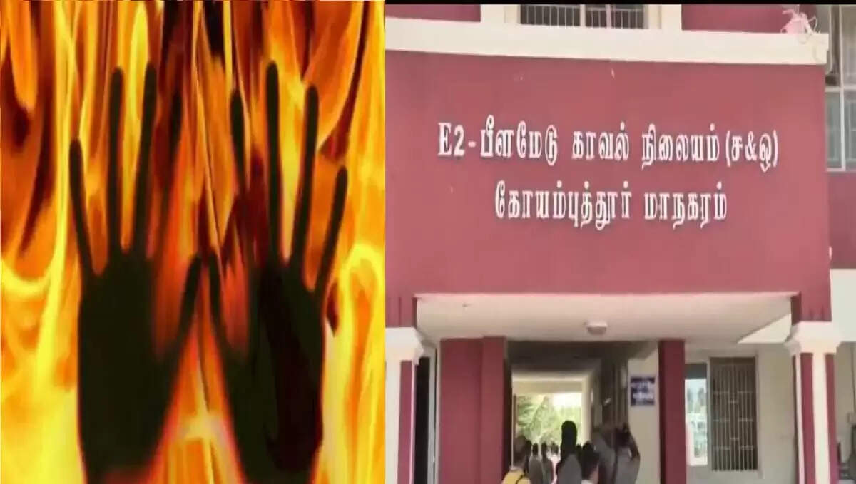 கோவை கொடிசியா அருகே பகீர் சம்பவம்.!சம்பளம் கேட்ட செக்யூரிட்டியை கொளுத்திய நிறுவனத்தின் உரிமையாளர்..
