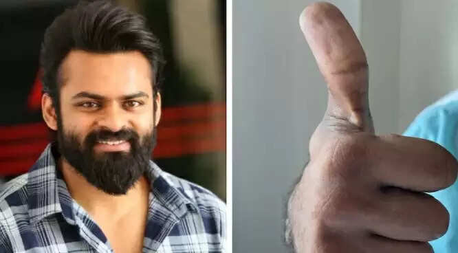 பெரும் மகிழ்ச்சி.. விபத்தில் சிக்கி 24 நாட்களுக்கு பிறகு நினைவு திரும்பிய பிரபல நடிகர் !!