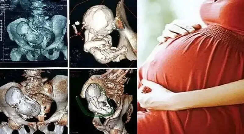pregnant 1