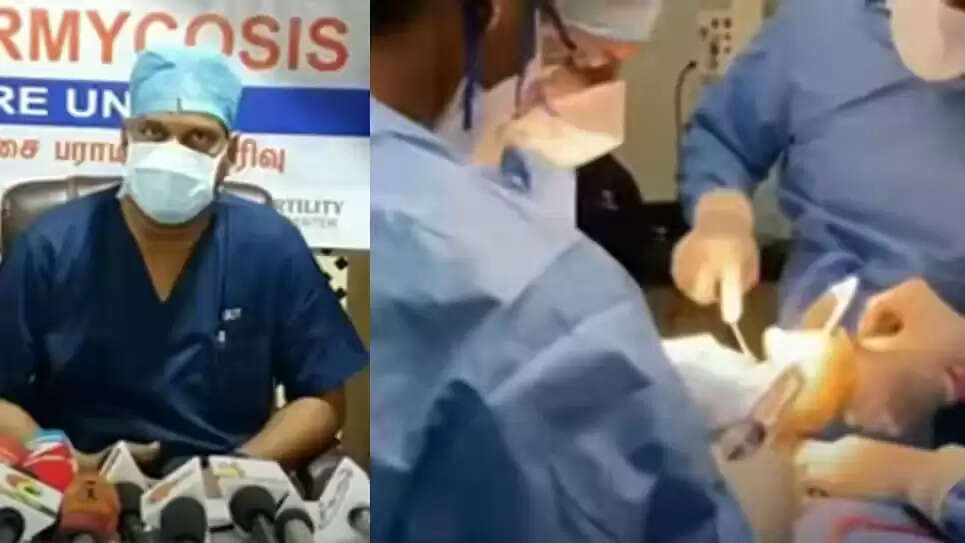 கறுப்பு பூஞ்சையால் பாதிக்கப்பட்டவருக்கு ஆபரேஷன் செய்த திமுக எம்பி..!