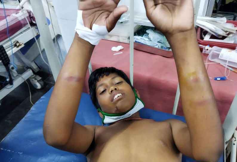 யார் மீதோ இருந்த கோபத்தை மாணவன் மீது காட்டிய ஆசிரியர்!!