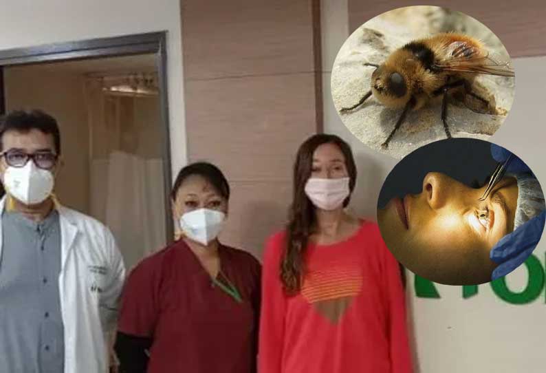 அமெரிக்க பெண் உடலுக்குள் ஊடுருவிய 3 ஈக்களை அகற்றி சாதனை படைத்த இந்திய மருத்துவர்கள்..!!