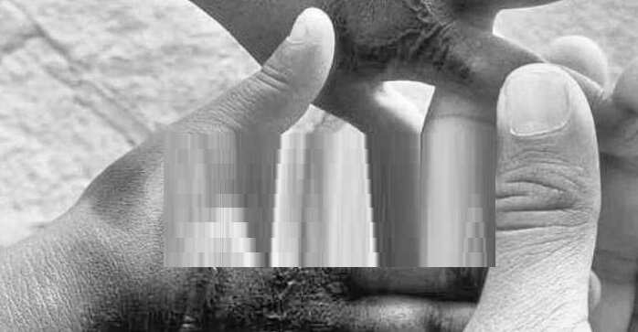 பசிக்குது.. உணவு கேட்ட குழந்தைக்கு சூடுவைத்த வளர்ப்புத் தாய் !